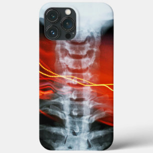 Ray Digital Artwork Phone Case
