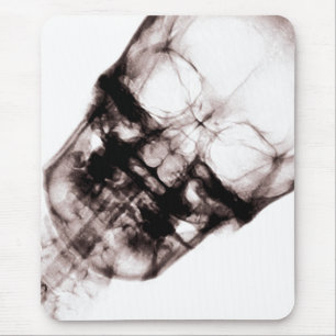 Ray Vision Skeleton Skull Face Mousepad