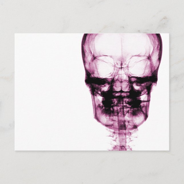 Ray Vision Skeleton Skull - Rosa Postkarte (Vorderseite)