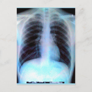 Ribcage Xray Skeleton Postkarte