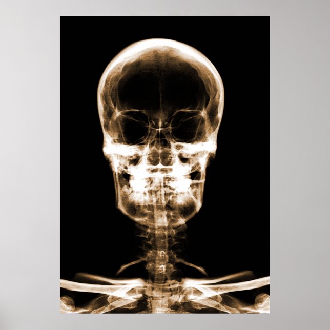 RÖHRLICHER VISION SKELETON SKULL - ORANGE POSTER (Vorne)