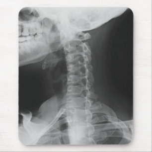 Röntgen 2 mousepad