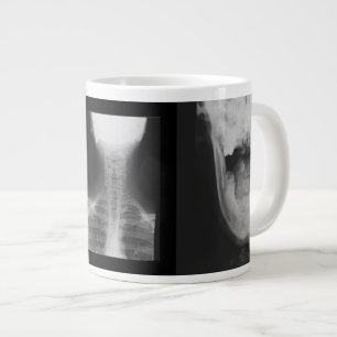 Röntgen 3 Jumbo-Tasse
