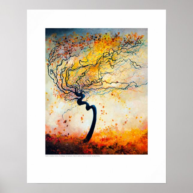 Röntgen-Deckkunst - Stormy Cerebral von L. Rainey Poster (Vorne)