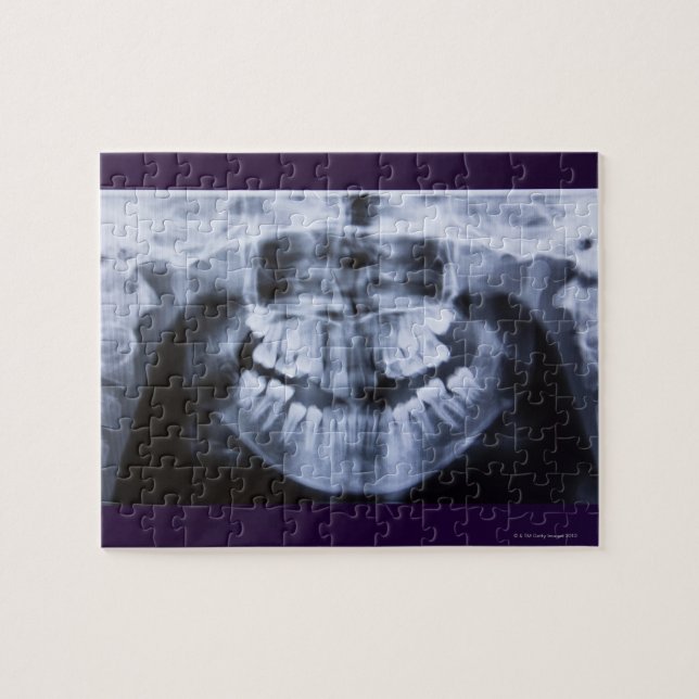 Röntgen eines Mädchenjungen mit Panoramablick Puzzle (Horizontal)