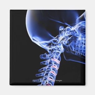 Röntgen Sie Bild der Knochen des Halses Magnet