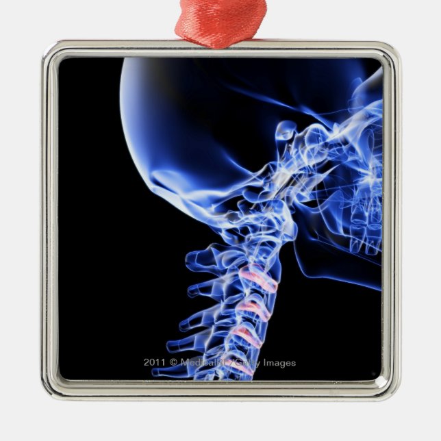 Röntgen Sie Bild der Knochen des Halses Silbernes Ornament (Vorne)