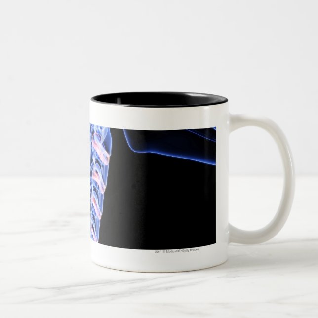 Röntgen Sie Bild der Knochen des Halses Zweifarbige Tasse (Rechts)