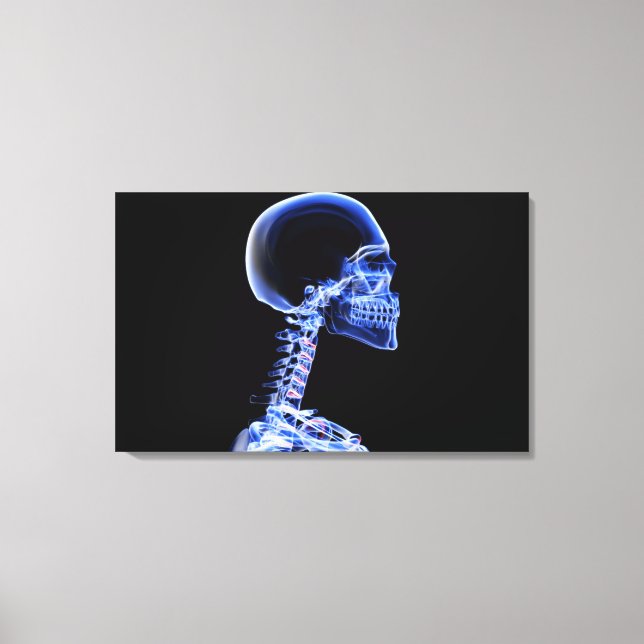 Röntgenaufnahme der Knochen im Nacken Leinwanddruck (Vorderseite)