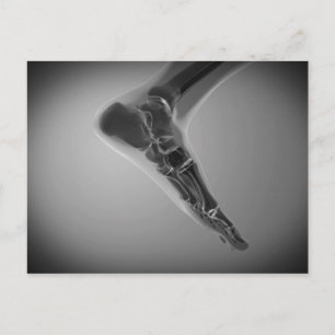 Röntgenaufnahme des menschlichen Fußes 4 Postkarte