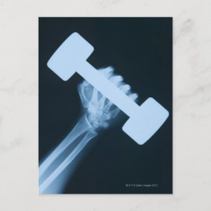Röntgenbild der menschlichen Hand mit Gewicht, nah Postkarte