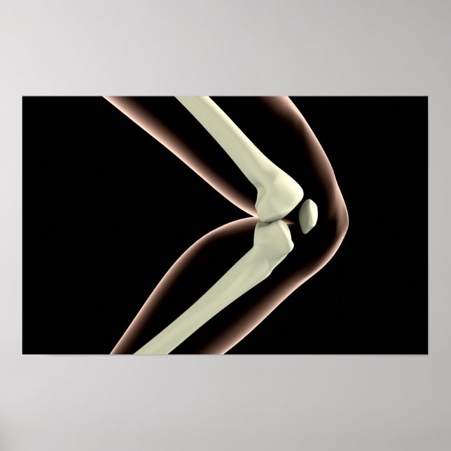Röntgenbild des Knies 1 Poster (Vorne)