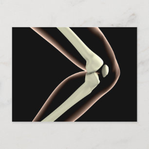 Röntgenbild des Knies 1 Postkarte
