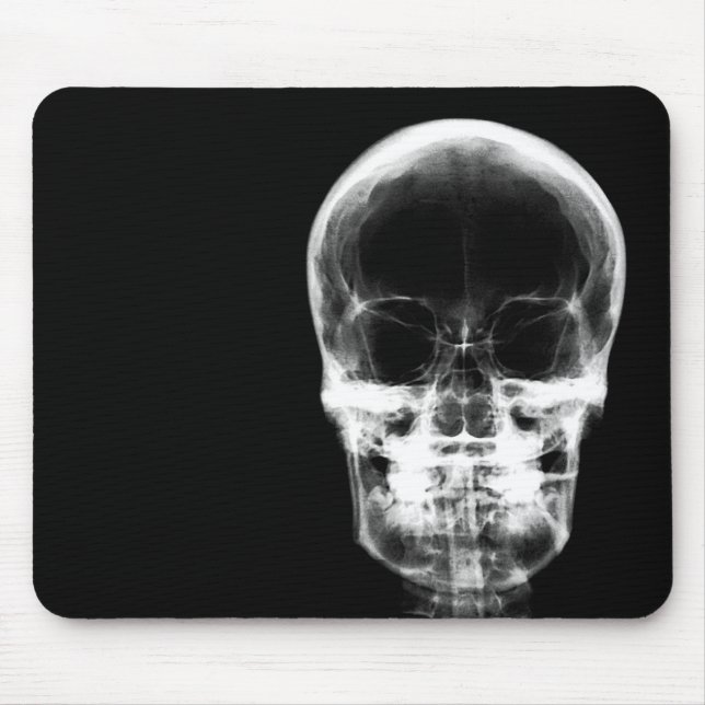 RÖNTGENBLICK-SKELETON SCHÄDEL - B&W MOUSEPAD (Vorne)