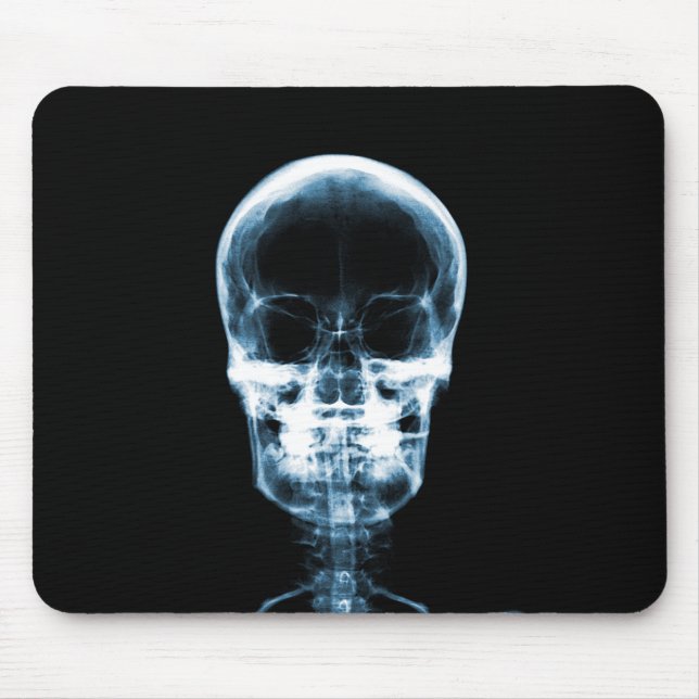 RÖNTGENBLICK-SKELETON SCHÄDEL - BLAU MOUSEPAD (Vorne)