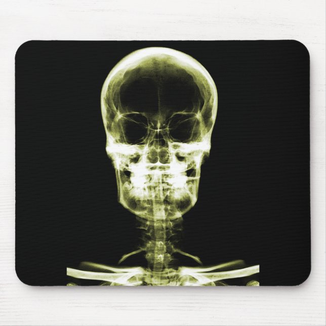 RÖNTGENBLICK-SKELETON SCHÄDEL - GELB MOUSEPAD (Vorne)