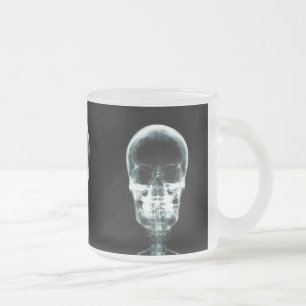 RÖNTGENBLICK-SKELETON SCHÄDEL - VORLAGE MATTGLASTASSE