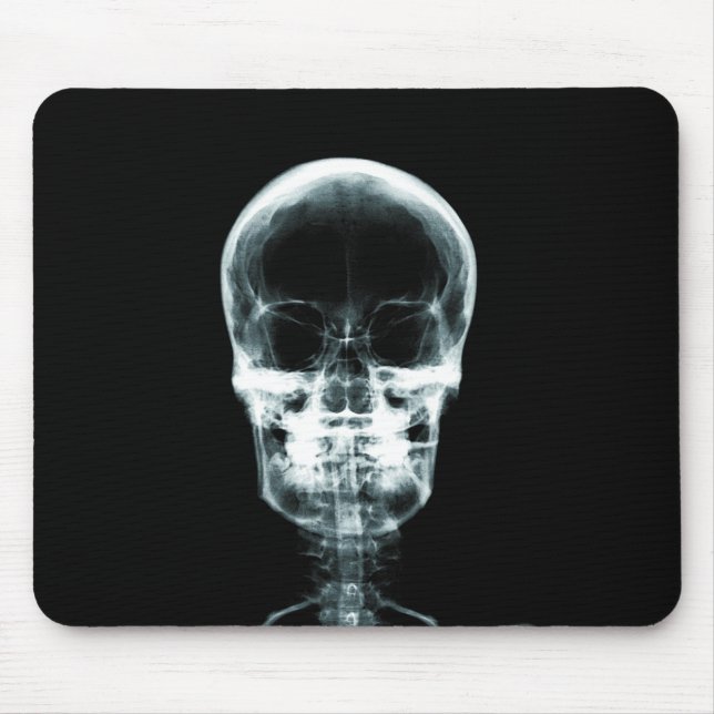 RÖNTGENBLICK-SKELETON SCHÄDEL - VORLAGE MOUSEPAD (Vorne)