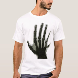 Röntgenhand mit überzähligem Finger-Shirt T-Shirt