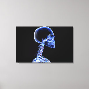 Röntgenstrahl der Knochen im Hals Leinwanddruck