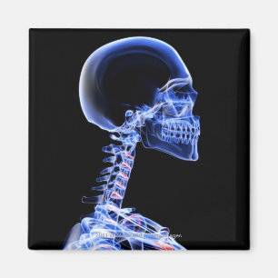 Röntgenstrahl der Knochen im Hals Magnet