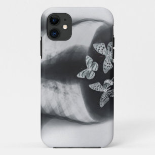 Röntgenstrahl der Schmetterlinge im Magen Case-Mate iPhone Hülle