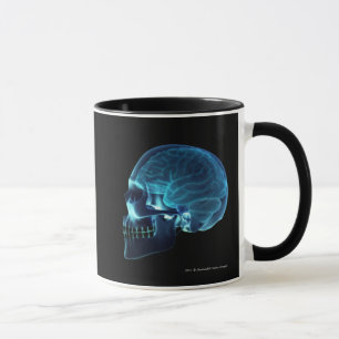Röntgenstrahl des Gehirns innerhalb eines Schäde Tasse