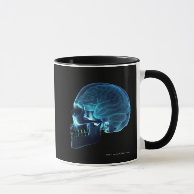 Röntgenstrahl des Gehirns innerhalb eines Schädels Tasse (Rechts)