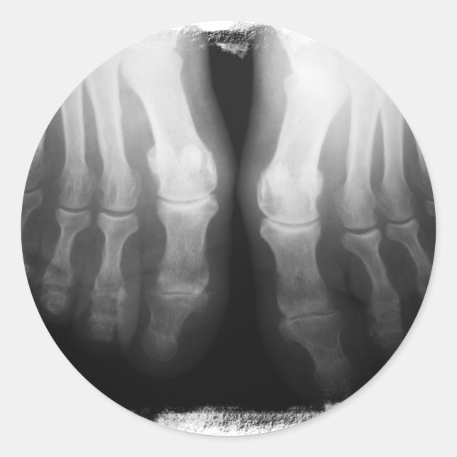 Röntgenstrahl-Fuß-menschliches Skeleton Runder Aufkleber (Vorderseite)