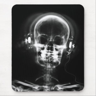 RÖNTGENSTRAHL-MUSIK-SKELETON GRAUES SCHWARZES U. MOUSEPAD