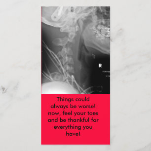 Röntgenstrahl, Sachen konnte schlechter immer Dankeskarte