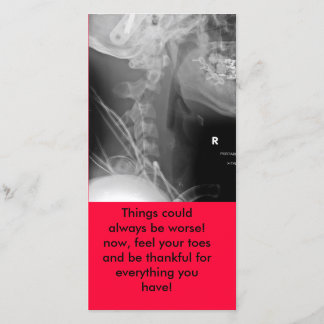 Röntgenstrahl, Sachen konnte schlechter immer Dankeskarte