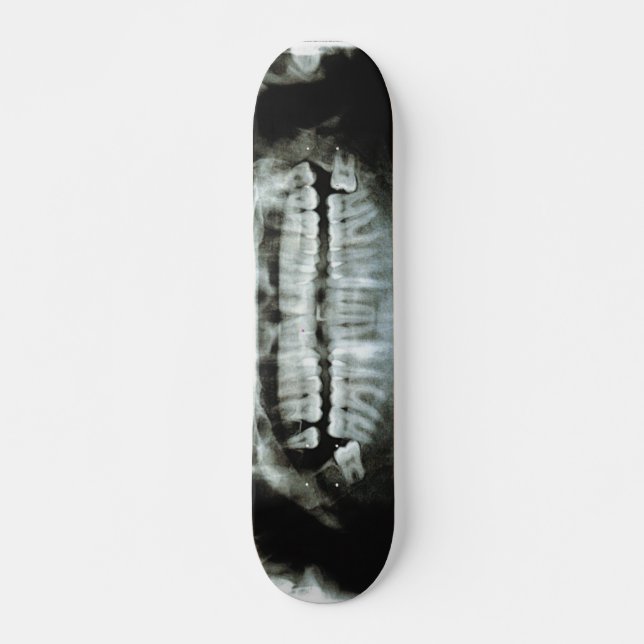 Röntgenstrahl Skateboard (Vorne)