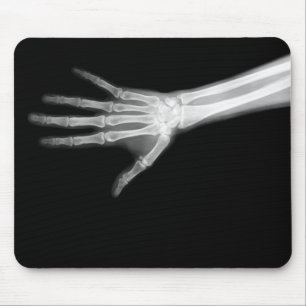 RÖNTGENSTRAHL-SKELETON ARM B&W MOUSEPAD