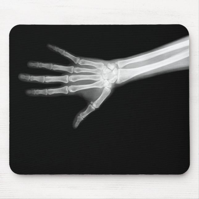 RÖNTGENSTRAHL-SKELETON ARM B&W MOUSEPAD (Vorne)