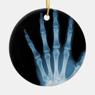 RÖNTGENSTRAHL-SKELETON HANDfinger BLAU Keramik Ornament