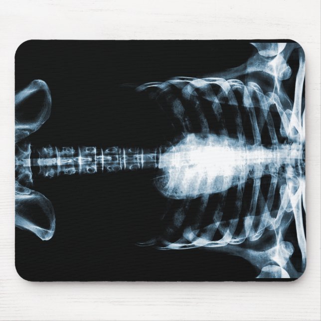 RÖNTGENSTRAHL-SKELETON TORSO-RIPPEN - BLAU MOUSEPAD (Vorne)