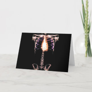 RÖNTGENSTRAHL-SKELETON TORSO VERSIEHT VORLAGE MIT