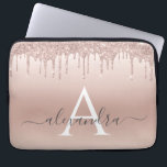 Rosa-Glitzer und Sparklogramm Laptopschutzhülle<br><div class="desc">Rosa Rose Gold Imitate Glitzer und sparkle Elegant Monogram Case. Dieser Fall kann so angepasst werden,  dass er Ihren Anfangs- und Vornamen enthält.</div>