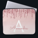 Rosa-Glitzer und Sparklogramm Laptopschutzhülle<br><div class="desc">Blush Pink - Rose Gold Imitate Dripping Glitzer und sparkle elegante Monogram Laptop Gehäuse. Dieser mit Monogramm Fall kann so angepasst werden,  dass er Ihren Anfangs- und Vornamen enthält.</div>