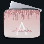 Rosa-Glitzer und Sparklogramm Laptopschutzhülle<br><div class="desc">Blush Pink - Rose Gold Imitate Dripping Glitzer und sparkle elegante Monogram Laptop Gehäuse. Dieser mit Monogramm Fall kann so angepasst werden,  dass er Ihren Anfangs- und Vornamen enthält.</div>