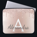 Rosa Rose Gold Metallischer Glitzer Monogramm Laptopschutzhülle<br><div class="desc">Rosa Rose Gold Glitzer und glatter,  moderner und eleganter Monogramm-Case. Dieses Gehäuse kann auf Ihren Anfangs- und Vornamen angepasst werden und macht ein großartiges mädchenhaftes oder süßes 16 Geburtstagsgeschenk.</div>