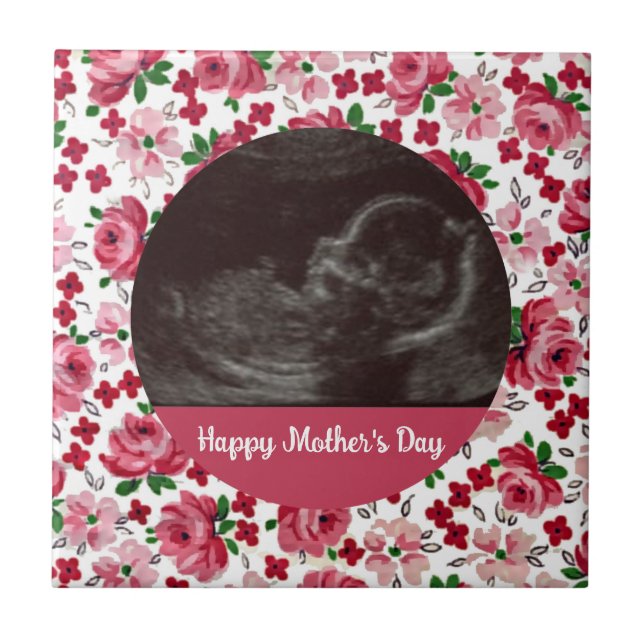 Rosa Rosen Custom Ultrasound Mutter Day Tile Fliese (Vorderseite)