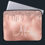 Rose Gold Glitzer Tropfen Monogram Laptopschutzhülle<br><div class="desc">Dieses Design kann in dem Bereich personalisiert werden, der durch das Ändern des Fotos und/oder Textes zur Verfügung gestellt wird. Sie können auch angepasst werden, indem Sie auf Vorlage personalisieren klicken und dann auf die Schaltfläche klicken, um weitere Optionen anzupassen, um die Hintergrundfarbe zu löschen oder zu ändern, Text hinzuzufügen,...</div>