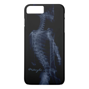 Schöner, personalisierter Körper-Röntgenstrahl Case-Mate iPhone Hülle