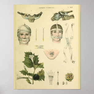 Schultergelenk-Schlüsselbein-Anatomie-Kunst Vintag Poster