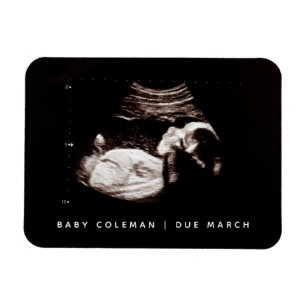 Schwangerschaft Ankündigung Baby Sonogram Foto Magnet