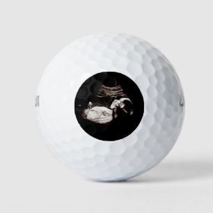 Schwangerschaft Baby Sonogram Ultraschall Foto Män Golfball