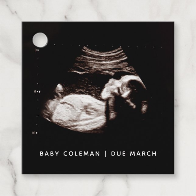 Schwangerschaft Baby Sonogram Ultraschallgerät Fot Geschenkanhänger (Vorderseite)