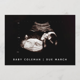 Schwangerschaft Baby Sonogramm Ultraschallbild-Kar Einladung